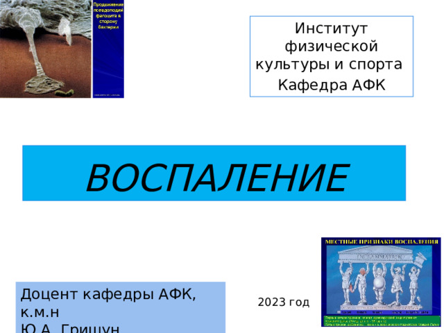 Институт физической культуры и спорта Кафедра АФК ВОСПАЛЕНИЕ Доцент кафедры АФК, к.м.н Ю.А. Гришун 2023 год 