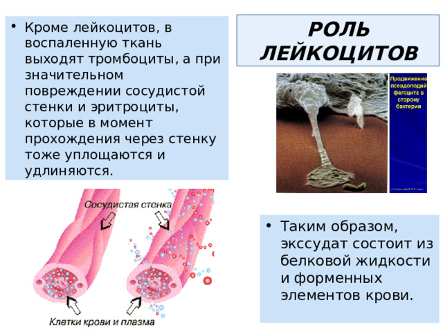 РОЛЬ ЛЕЙКОЦИТОВ Кроме лейкоцитов, в воспаленную ткань выходят тромбоциты, а при значительном повреждении сосудистой стенки и эритроциты, которые в момент прохождения через стенку тоже уплощаются и удлиняются. Таким образом, экссудат состоит из белковой жидкости и форменных элементов крови. 