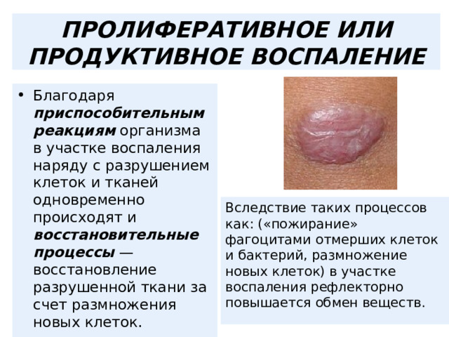 ПРОЛИФЕРАТИВНОЕ ИЛИ ПРОДУКТИВНОЕ ВОСПАЛЕНИЕ Благодаря приспособительным реакциям организма в участке воспаления наряду с разрушением клеток и тканей одновременно происходят и восстановительные процессы — восстановление разрушенной ткани за счет размножения новых клеток.  Вследствие таких процессов как: («пожирание» фагоцитами отмерших клеток и бактерий, размножение новых клеток) в участке воспаления рефлекторно повышается обмен веществ. 