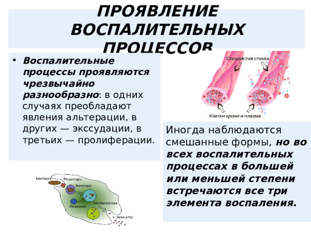 ПРОЯВЛЕНИЕ ВОСПАЛИТЕЛЬНЫХ ПРОЦЕССОВ Воспалительные процессы проявляются чрезвычайно разнообразно : в одних случаях преобладают явления альтерации, в других — экссудации, в третьих — пролиферации. Иногда наблюдаются смешанные формы, но во всех воспалительных процессах в большей или меньшей степени встречаются все три элемента воспаления.  