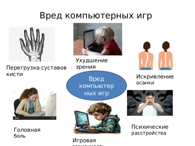 Вред компьютерных игр Ухудшение зрения Перегрузка суставов кисти Вред компьютерных игр Искривление осанки Психические расстройства Головная боль Игровая зависимость 