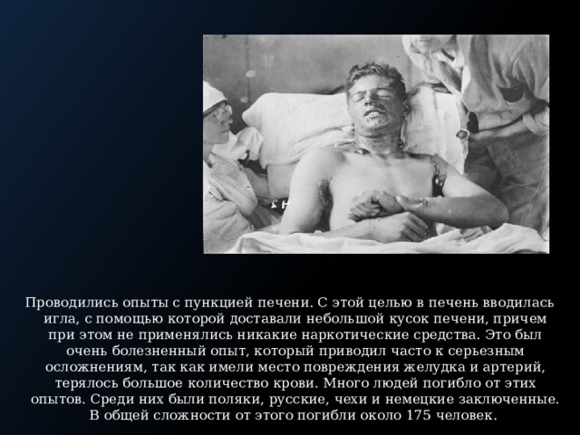 Проводились опыты с пункцией печени. С этой целью в печень вводилась игла, с помощью которой доставали небольшой кусок печени, причем при этом не применялись никакие наркотические средства. Это был очень болезненный опыт, который приводил часто к серьезным осложнениям, так как имели место повреждения желудка и артерий, терялось большое количество крови. Много людей погибло от этих опытов. Среди них были поляки, русские, чехи и немецкие заключенные. В общей сложности от этого погибли около 175 человек. 