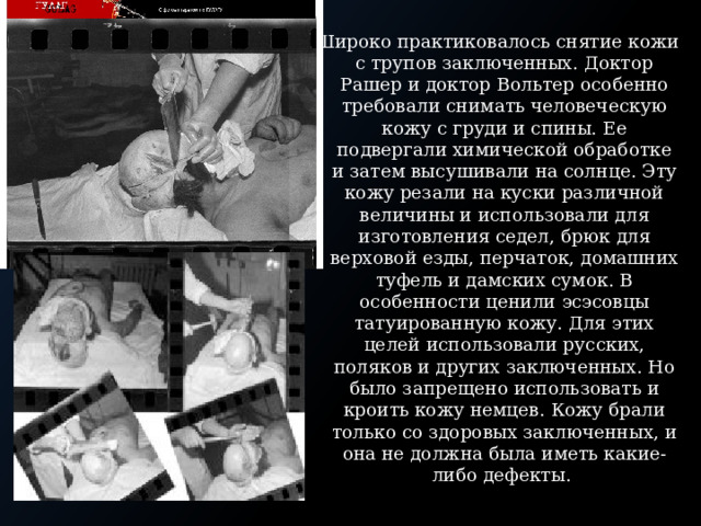Широко практиковалось снятие кожи с трупов заключенных. Доктор Рашер и доктор Вольтер особенно требовали снимать человеческую кожу с груди и спины. Ее подвергали химической обработке и затем высушивали на солнце. Эту кожу резали на куски различной величины и использовали для изготовления седел, брюк для верховой езды, перчаток, домашних туфель и дамских сумок. В особенности ценили эсэсовцы татуированную кожу. Для этих целей использовали русских, поляков и других заключенных. Но было запрещено использовать и кроить кожу немцев. Кожу брали только со здоровых заключенных, и она не должна была иметь какие-либо дефекты. 