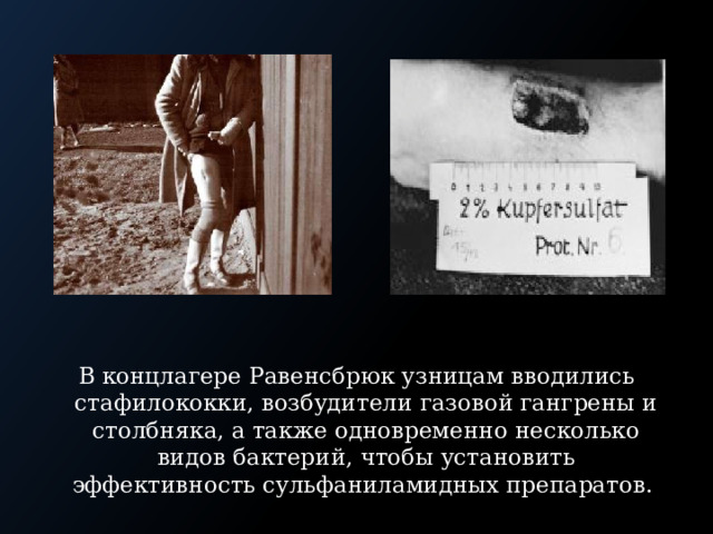 В концлагере Равенсбрюк узницам вводились стафилококки, возбудители газовой гангрены и столбняка, а также одновременно несколько видов бактерий, чтобы установить эффективность сульфаниламидных препаратов. 