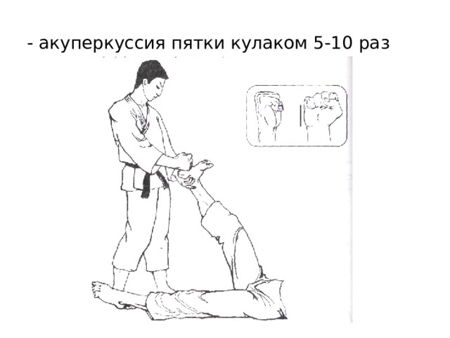 - акуперкуссия пятки кулаком 5-10 раз 