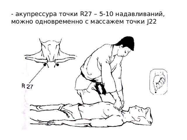 - акупрессура точки R27 – 5-10 надавливаний, можно одновременно с массажем точки J22 