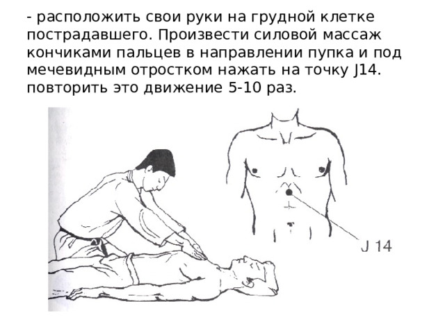 - расположить свои руки на грудной клетке пострадавшего. Произвести силовой массаж кончиками пальцев в направлении пупка и под мечевидным отростком нажать на точку J14 . повторить это движение 5-10 раз. 
