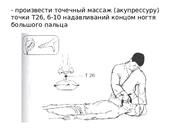 - произвести точечный массаж (акупрессуру) точки T 26, 6-10 надавливаний концом ногтя большого пальца 