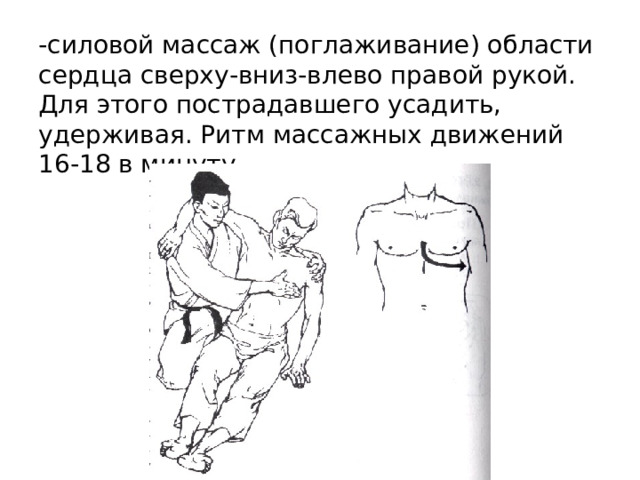 -силовой массаж (поглаживание) области сердца сверху-вниз-влево правой рукой. Для этого пострадавшего усадить, удерживая. Ритм массажных движений 16-18 в минуту 