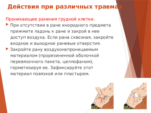 Действия при различных травмах Проникающие ранения грудной клетки. При отсутствии в ране инородного предмета прижмите ладонь к ране и закрой в нее доступ воздуха. Если рана сквозная, закройте входное и выходное раневые отверстия. Закройте рану воздухонепроницаемым материалом (прорезиненной оболочкой перевязочного пакета, целлофаном), герметизируя ее. Зафиксируйте этот материал повязкой или пластырем.  