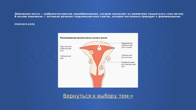  Лейомиома матки — доброкачественное новообразование, которое возникает из миометрия (мышечного слоя матки).  В основе появления — активное деление гладкомышечных клеток, которое постепенно приводит к формированию плотного узла  Вернуться к выбору тем→  