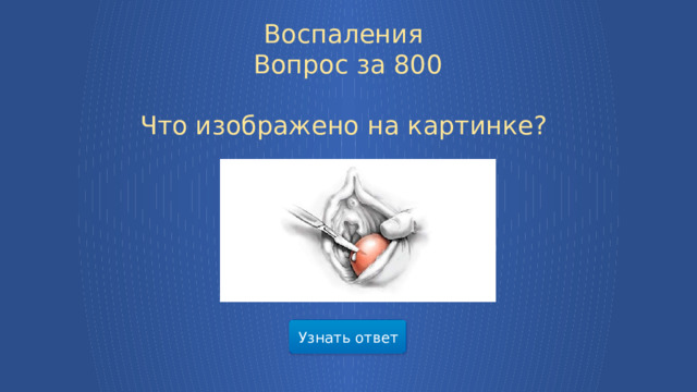 Воспаления  Вопрос за 800 Что изображено на картинке? Узнать ответ  