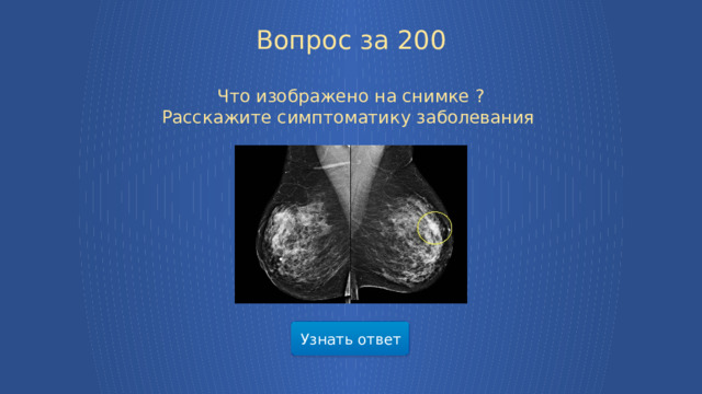 Вопрос за 200 Что изображено на снимке ? Расскажите симптоматику заболевания    Узнать ответ  