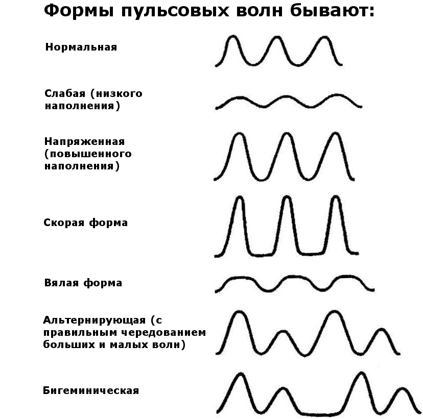 Характеристика пульса которая определяется на данном рисунке